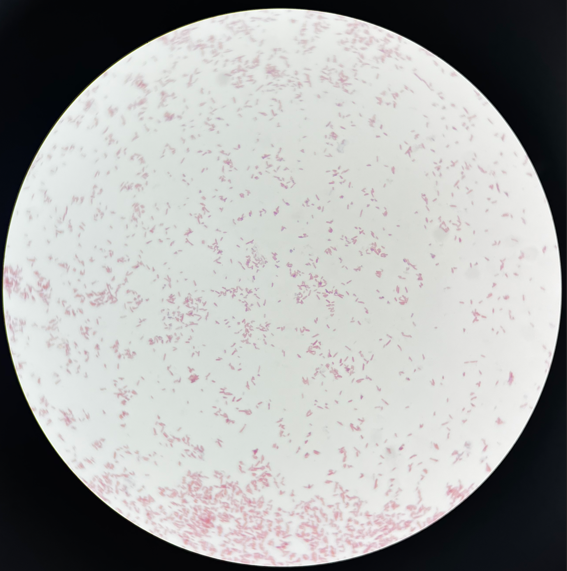 制藥行業中的隱形殺手-洋蔥伯克霍爾德菌群 制藥行業中的隱形殺手-洋蔥伯克霍爾德菌群