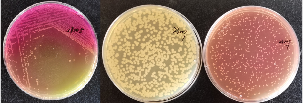 制藥行業中的隱形殺手-洋蔥伯克霍爾德菌群 制藥行業中的隱形殺手-洋蔥伯克霍爾德菌群