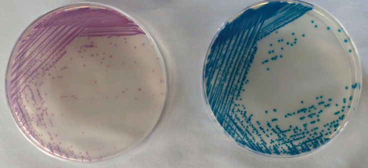 沙門檢測新助手—沙門氏+顯色培養(yǎng)基